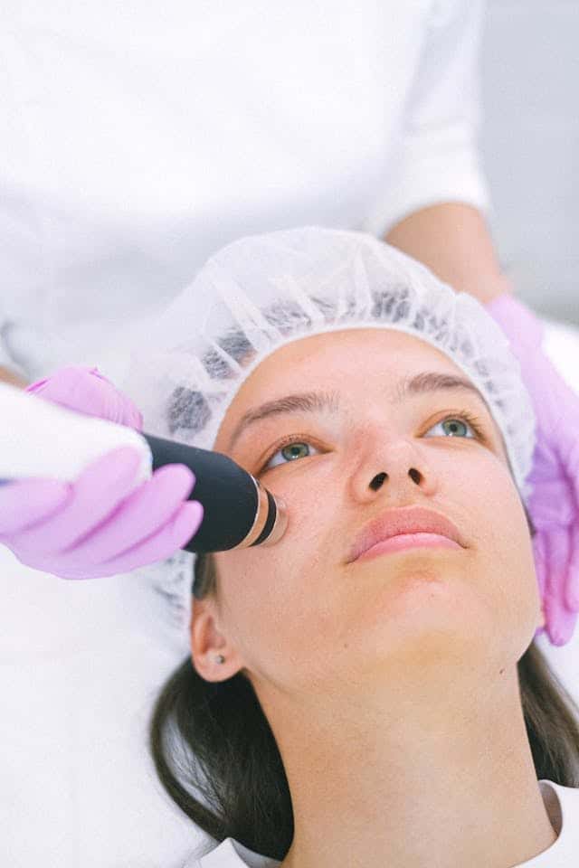 Dermapen procedura