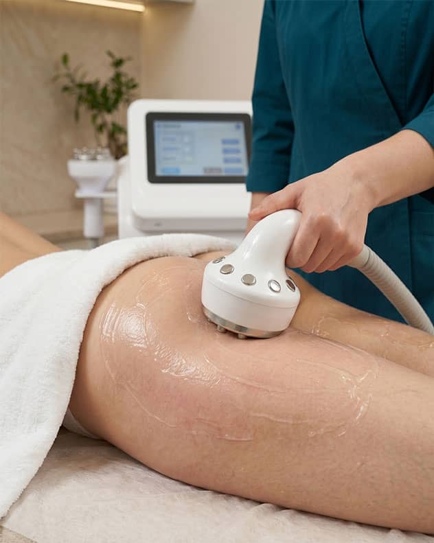 Radiofrekvence ķermenim pakalpojuma attēls Salons Unda